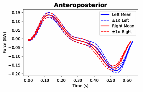 Anteroposterior GRF graph.